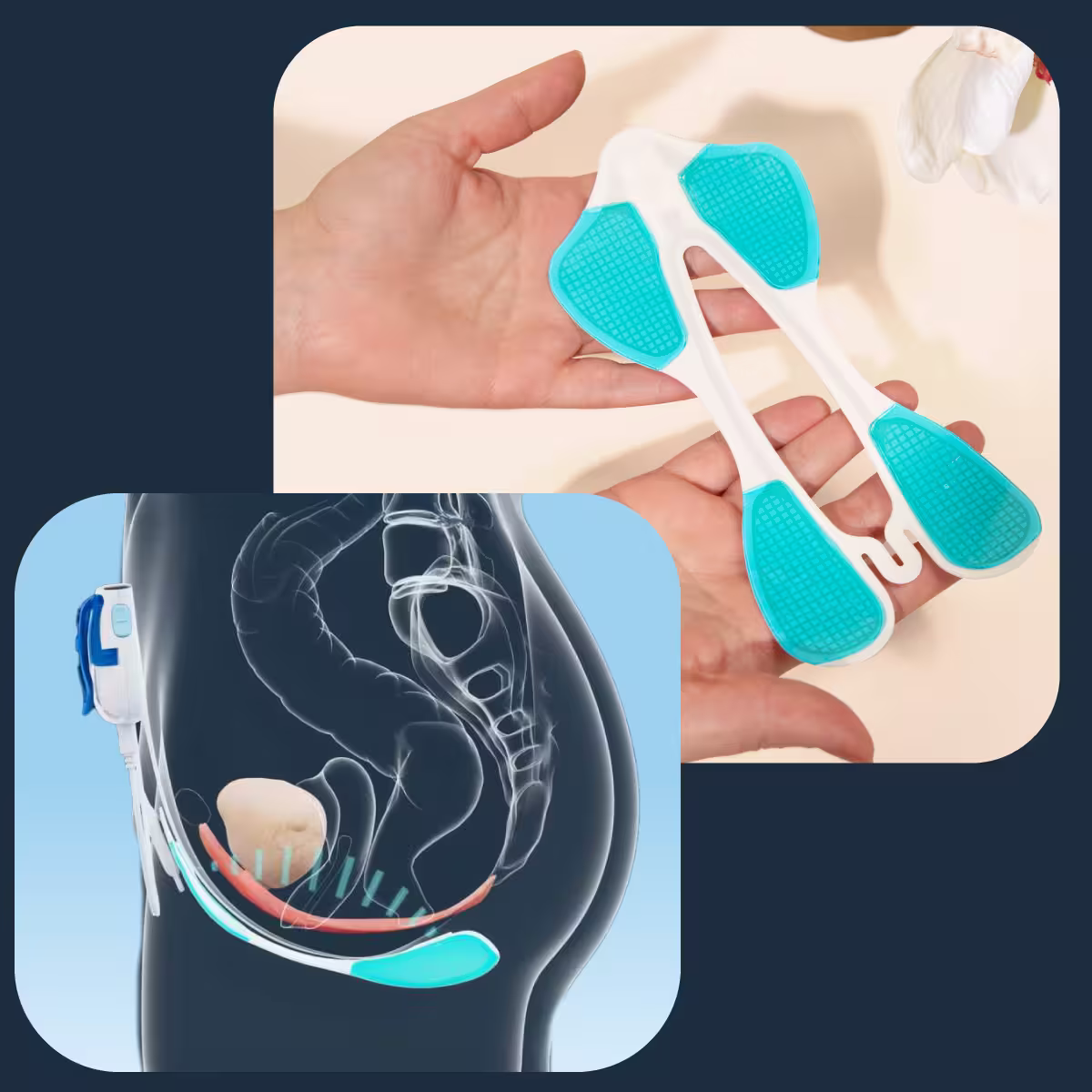 gelpad and how the signals go through the muscles