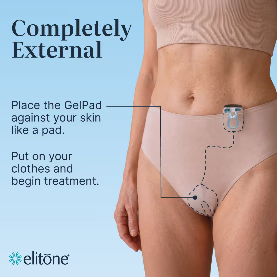 Completely external - place the GelPad against your skin like a pad. put on your clothes and begin treatment