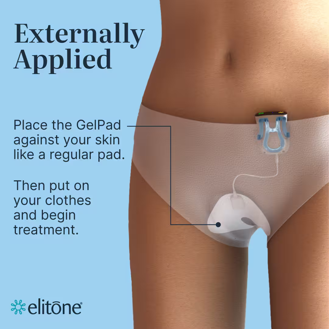 SUI Gallery - AVIF-12 SUI Gallery AVIF 12