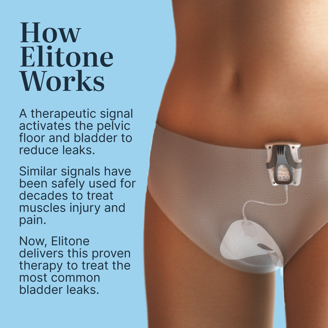 Gallery Stories 080525 06