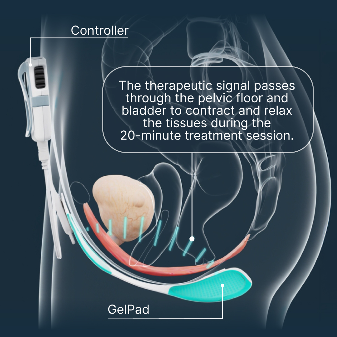 Gallery Stories 080525 09