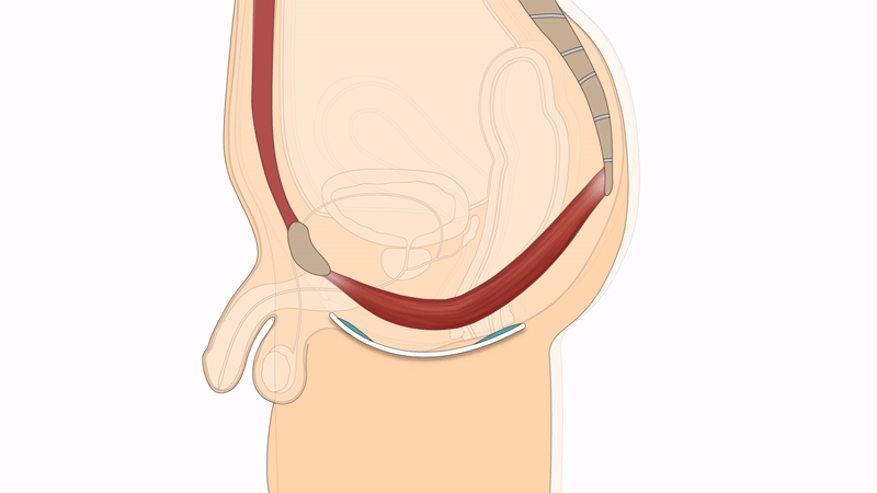 Men HP 68 Male Pelvic Floor GIF 750K
