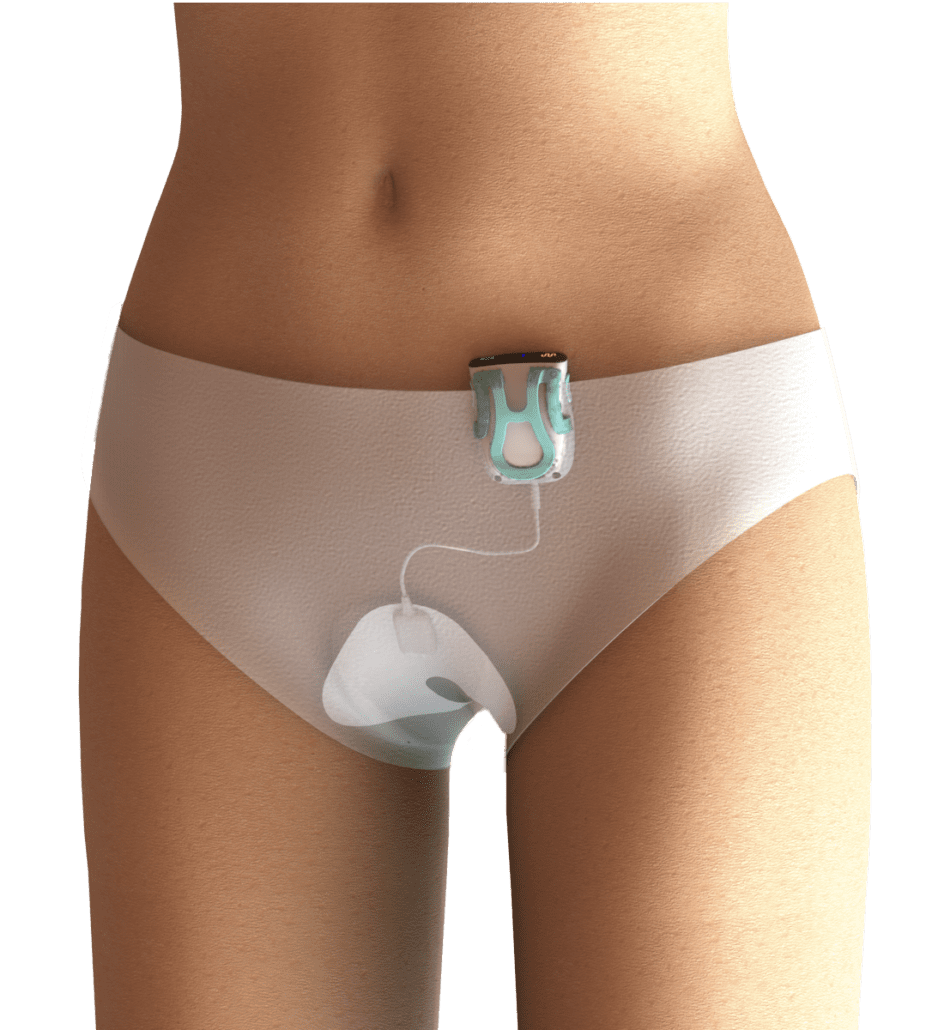 Anatomic-G4-3 Anatomic G4 3