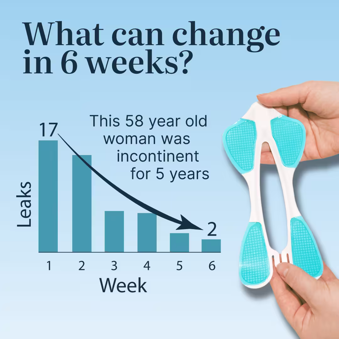 What can change in 6 weeks? This 58 year old woman was incontinence for 5 years and went from 17 to 2 leaks per week.