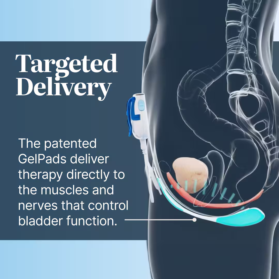 Target delivery: The patented Gelpads deliver therapy directly to the muscles and nerves that control bladder function.